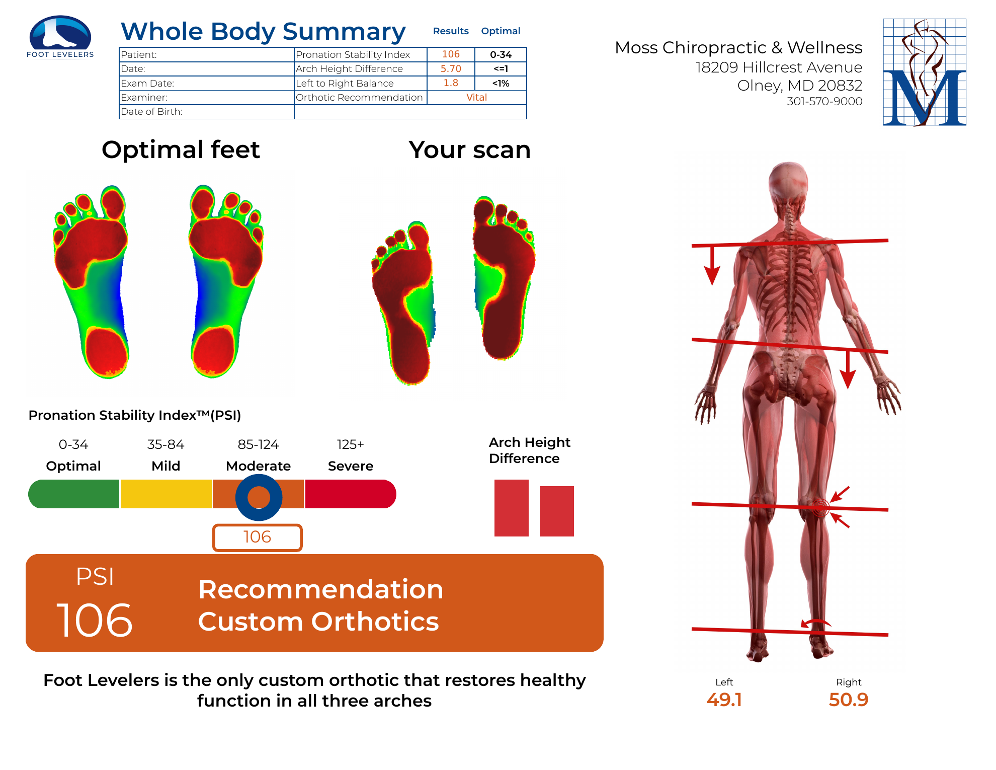 Page 1 of the Foot Leveler Template: sample foot scans, arch height, and balance summary